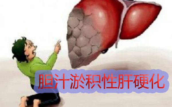 郑州市好的肝硬化医院是哪家